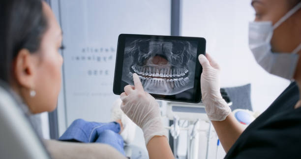 Licensed Dental Veneers service in Weatherford, OK - Smile Center Dentistry